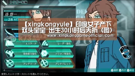 【xingkongyule】印度女子产下双头宝宝 出生30小时后夭折(图)(图3) 星空娱乐官方下载