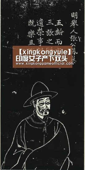 【xingkongyule】印度女子产下双头宝宝 出生30小时后夭折(图)(图4) 星空娱乐